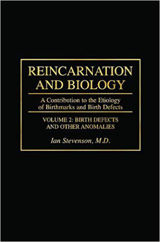 Stevenson-Reincarnation and Biology-A Contribution to the Etiology of Birthmarks and Birth Defects